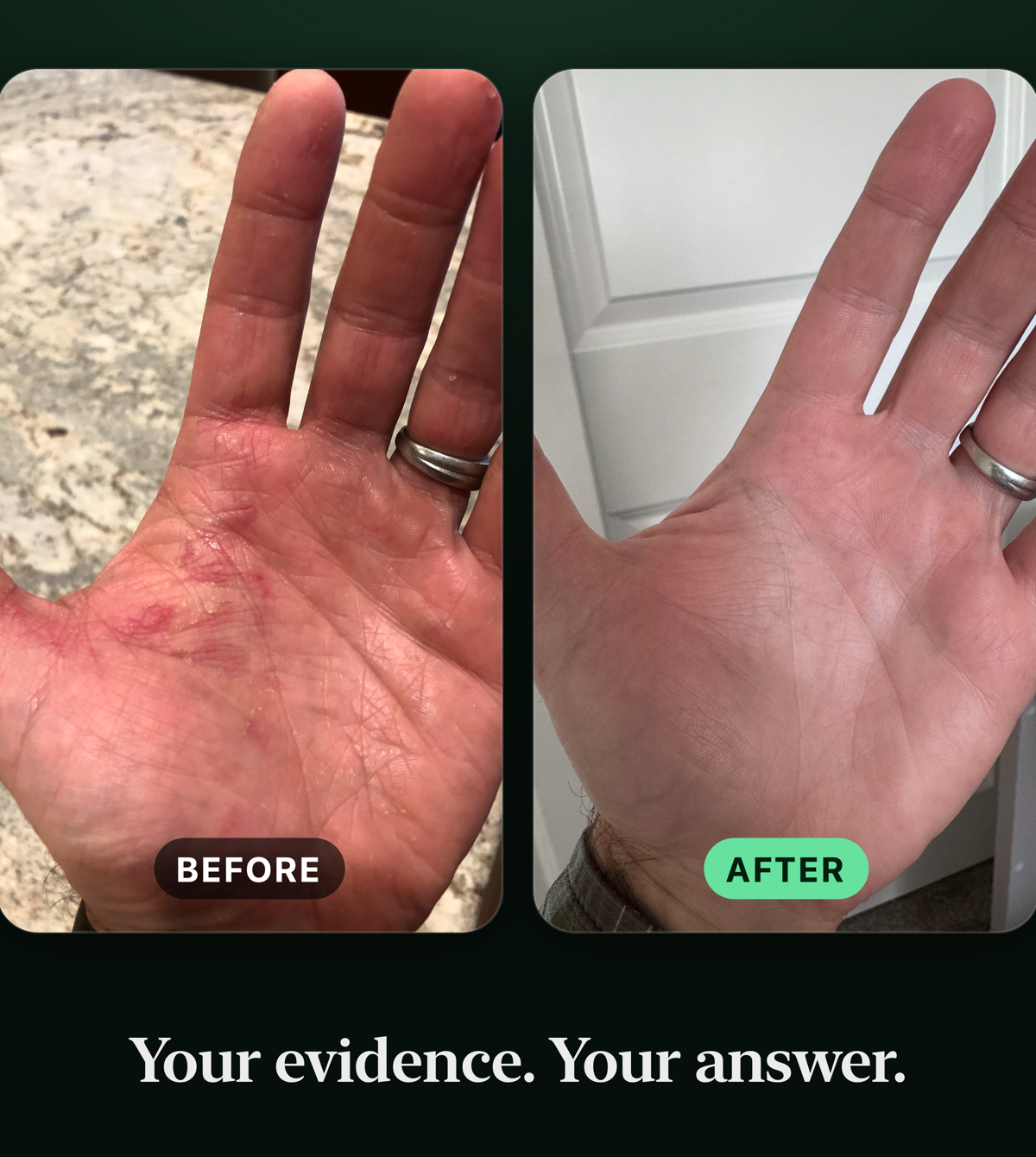 Before and after: a healed hand after finding the trigger